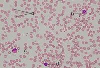 Fyziologický krevní nátěr (a - erytrocyty; b- neutrofil, c - eozinofil, d - lymfocyt)