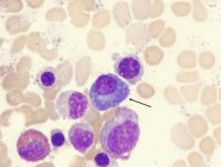 Plazmocyty