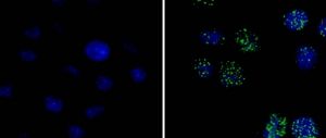 Označení buněk protilátkami specifickými pro γH2AX bez ozáření (nalevo)  a po ozáření 5 Gy (napravo)