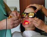 Terapeutický laser používaný ve stomatologii